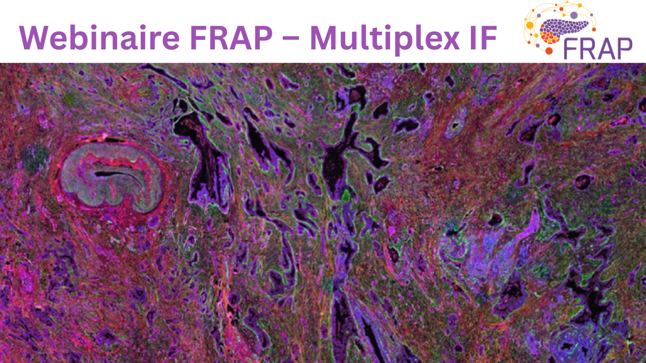 Webinaire FRAP – Technologie de Multiplex IF