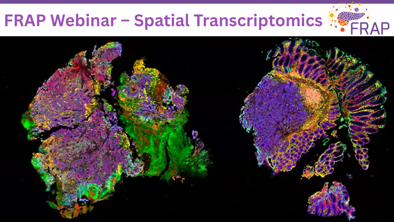 Replay – Spatial Transcriptomics Webinar